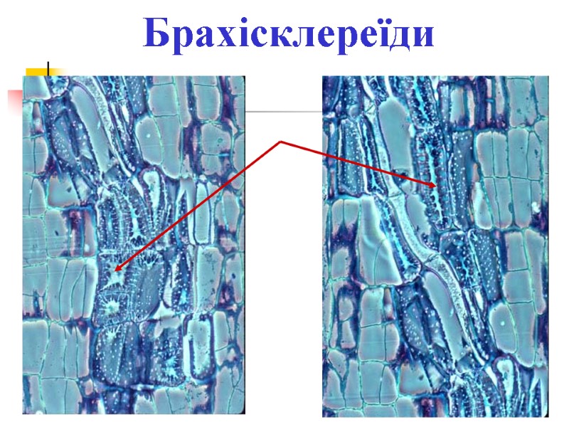 Брахісклереїди